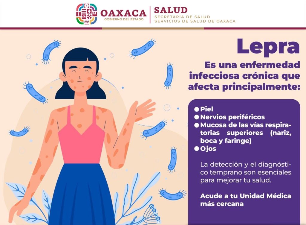 LEPRA