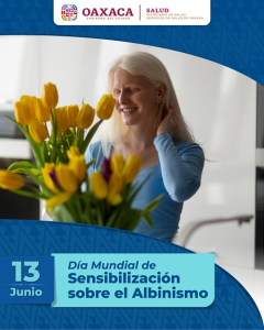 Conmemoran Día Internacional de la Sensibilización sobre el Albinismo 01