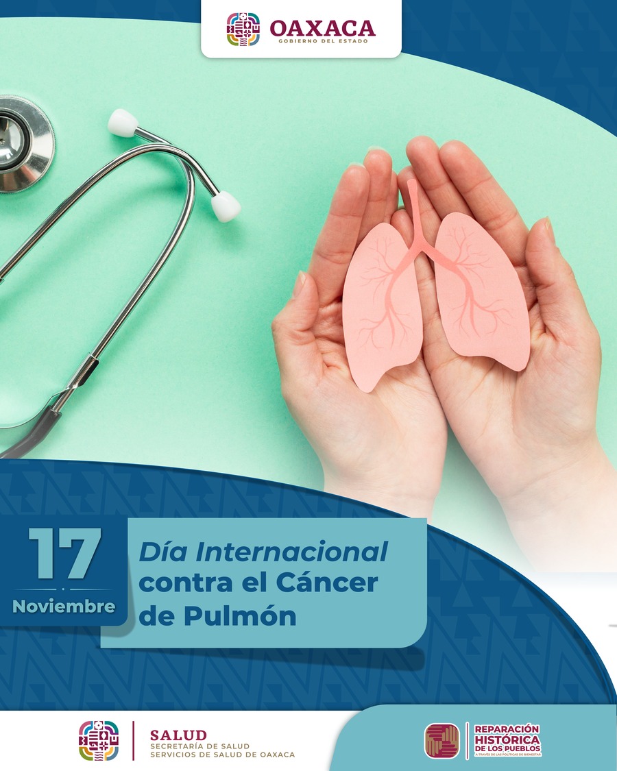 Alrededor del 70% de los casos de cáncer de pulmón son atribuibles al tabaco 3